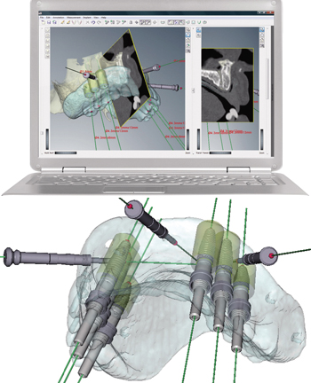 コンピューター3Dシミュレーション